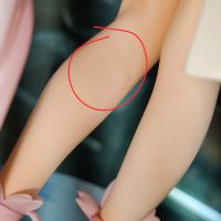 不知道会不会加重，记录一下