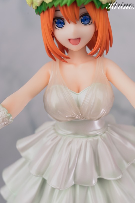 谁家唯一指定冠军穿的像个伴娘啊