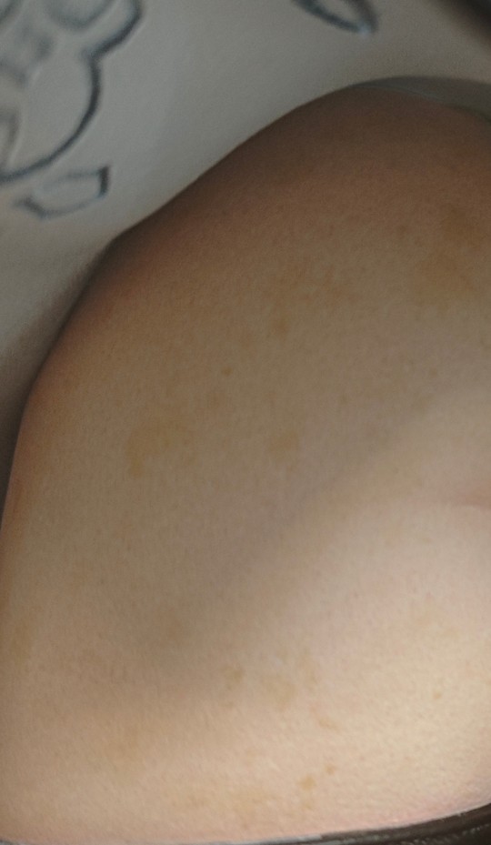 求助，2w买的雕像出现黄斑