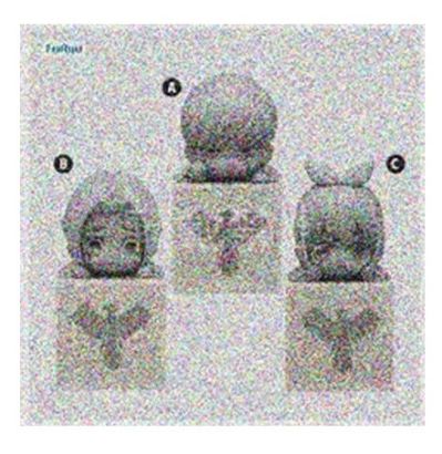 物理魔法使马修 趴趴1